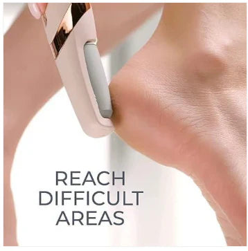 Callus Remover, Foot File Callus Remover