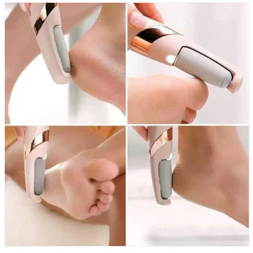 Callus Remover, Foot File Callus Remover